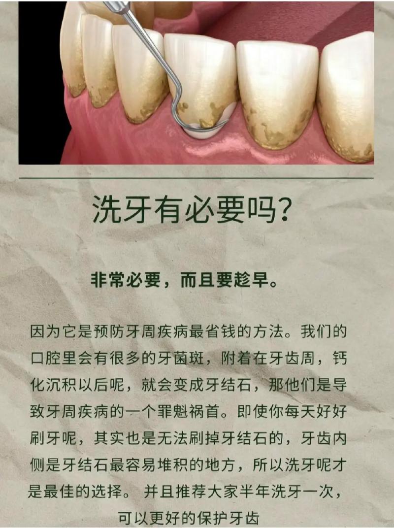 洗牙有什么利弊吗，你们洗过了多久，建不建议洗牙呢男子洗牙查出白血病视频牙龈易出血的人，能不能去洗牙呢？有何依据 车辆(134835)